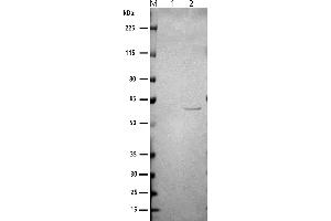 Western blot: anti-Norovirus GI M: Marker 1: (ABIN7538786) VLP_SARS-CoV-2 (S+M+E+N) 2: (ABIN7538804) VLP_Norovirus GI. (Norovirus GI.3 VP1+VP2 protein-VLP)