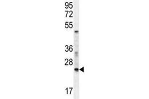 RAN antibody western blot analysis in mouse NIH3T3 lysate. (RAN Antikörper  (AA 112-140))