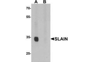 Western blot analysis of SLAIN1 in A549 cell lysate with SLAIN1 antibody at 1 ug/mL in (A) the absence and (B) the presence of blocking peptide. (SLAIN1 Antikörper  (C-Term))