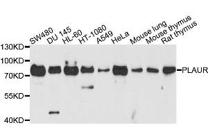 Western blot analysis of extracts of various cell lines, using PLAUR antibody. (PLAUR Antikörper  (AA 23-305))