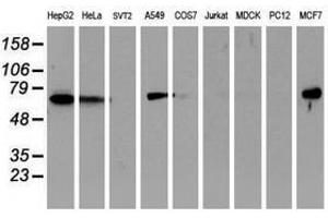 Image no. 3 for anti-Epsin 2 (EPN2) antibody (ABIN1498051) (Epsin 2 Antikörper)