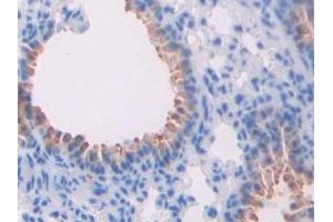 Immunohistochemistry (IHC) image for anti-Thrombospondin 2 (THBS2) (AA 968-1170) antibody (ABIN7435625)