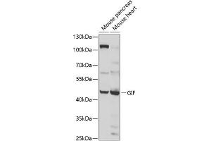 Western blot analysis of extracts of various cell lines, using GIF antibody (ABIN6130975, ABIN6141081, ABIN6141082 and ABIN6222649) at 1:1000 dilution. (Intrinsic Factor Antikörper  (AA 20-300))