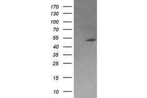 Image no. 5 for anti-Protein Phosphatase, Mg2+/Mn2+ Dependent, 1B (PPM1B) antibody (ABIN1500371) (PPM1B Antikörper)