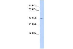 WB Suggested Anti-ASAHL Antibody Titration:  0. (NAAA Antikörper  (Middle Region))