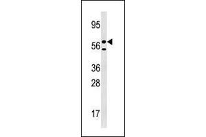 Western blot analysis of anti-URKL1 Pab in 293 cell line lysate (35 µg/lane). (UCKL1 Antikörper  (N-Term))