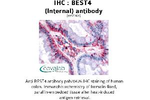 Image no. 1 for anti-Bestrophin 4 (BEST4) (Internal Region) antibody (ABIN1732305) (Bestrophin 4 Antikörper  (Internal Region))