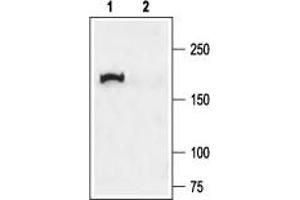 Western blot analysis of rat lung membranes: - 1. (CFTR Antikörper  (C-Term, Cytosolic))