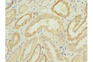 Immunohistochemistry of paraffin-embedded human kidney tissue using ABIN7147920 at dilution of 1:100 (CPSF4 Antikörper  (AA 1-244))