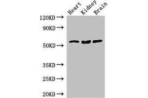 Western Blot Positive WB detected in: Mouse heart tissue, Mouse kidney tissue, Mouse brain tissue All lanes: SLC7A7 antibody at 3. (SLC7A7 Antikörper  (AA 325-382))