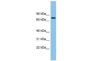 WB Suggested Anti-MTMR14 Antibody Titration: 0. (MTMR14 Antikörper  (Middle Region))