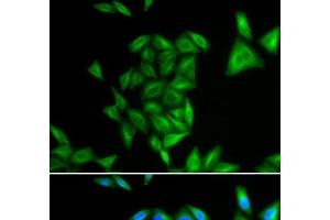Immunofluorescence analysis of U2OS cells using PHYH Polyclonal Antibody (PHYH Antikörper)