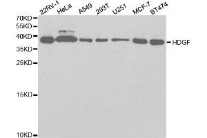 Western blot analysis of extracts of various cell lines, using HDGF antibody. (HDGF Antikörper)