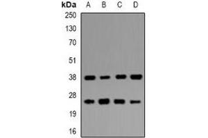 Western blot analysis of UBE2Z expression in MCF7 (A), HepG2 (B), mouse pancreas (C), mouse testis (D) whole cell lysates. (UBE2Z Antikörper)