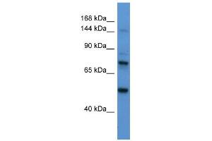 Astrotactin 2 antibody used at 1 ug/ml to detect target protein. (Astrotactin 2 Antikörper  (N-Term))