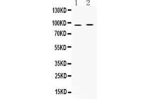 Western Blotting (WB) image for anti-A Kinase (PRKA) Anchor Protein 2 (AKAP2) (AA 813-852), (C-Term) antibody (ABIN5518729)