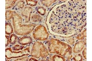 Immunohistochemistry of paraffin-embedded human kidney tissue using ABIN7170127 at dilution of 1:100 (SLC2A9 Antikörper  (AA 473-511))