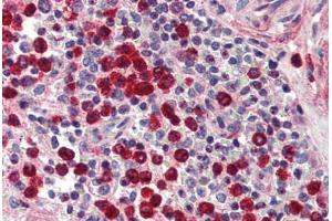 Human Spleen (formalin-fixed, paraffin-embedded) stained with MMP9 antibody ABIN337212 at 5 ug/ml followed by biotinylated goat anti-rabbit IgG secondary antibody ABIN481713, alkaline phosphatase-streptavidin and chromogen. (MMP 9 Antikörper)