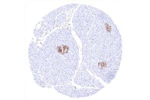 Immunohistochemistry (IHC) image for anti-Enolase 2 (Gamma, Neuronal) (ENO2) (AA 416-433) antibody (ABIN7477539)
