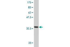 Western Blot detection against Immunogen (35. (FASTK Antikörper  (AA 67-154))