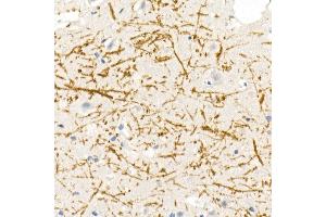 Immunohistochemistry of paraffin-embedded rat brain using Myelin Basic Protein Rabbit pAb (ABIN3022348, ABIN3022349, ABIN3022350 and ABIN6218754) at dilution of 1:100 (40x lens). (MBP Antikörper  (AA 1-197))
