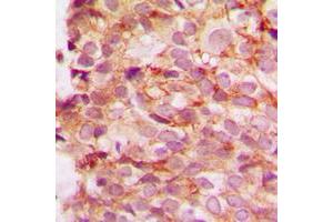 Immunohistochemistry (IHC) image for anti-Collagen, Type IV, alpha 1 (COL4A1) (N-Term) antibody (ABIN7295324)