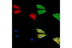 ABIN6260453 and ABIN6279232 staining Hela cells by IF/ICC.