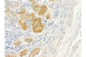 ABIN6258944 and ABIN6275125 at 1/100 staining human normal gastric tissue by IHC-P.