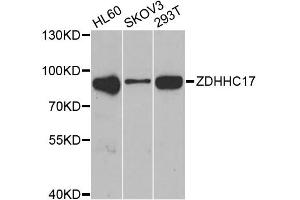 Western blot analysis of extracts of various cell lines, using ZDHHC17 antibody (ABIN2560820) at 1:1000 dilution. (ZDHHC17 Antikörper)