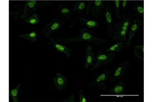 Immunofluorescence of monoclonal antibody to PQBP1 on HeLa cell.