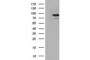 Western Blotting (WB) image for anti-Aldehyde Dehydrogenase 1 Family, Member L1 (ALDH1L1) antibody (ABIN1496581) (ALDH1L1 Antikörper)