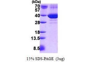 Family with Sequence Similarity 49, Member B (FAM49B) protein (His tag)