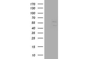 Image no. 1 for anti-DIX Domain Containing 1 (DIXDC1) antibody (ABIN1497841) (DIXDC1 Antikörper)
