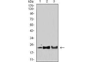 Western Blotting (WB) image for anti-Superoxide Dismutase 2, Mitochondrial (SOD2) (AA 1-222) antibody (ABIN5542468)