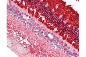 Anti-Rhodopsin / RHO antibody IHC staining of human retina. (Rhodopsin Antikörper)
