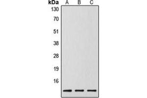 Western blot analysis of Caspase 14 p10 expression in MCF7 (A), mouse spleen (B), rat liver (C) whole cell lysates. (Caspase 14 p10 Antikörper  (Center))