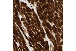 Immunohistochemical staining of human heart muscle with HRC polyclonal antibody  shows strong cytoplasmic positivity in myocytes. (HRC Antikörper)