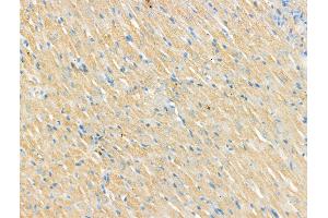 ABIN7094509 and ABIN7098558 at 1/100 staining Rat heart tissue by IHC-P.