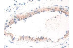 IHC-P analysis of Rat Lung Tissue, with DAB staining. (WARS Antikörper  (AA 140-347))