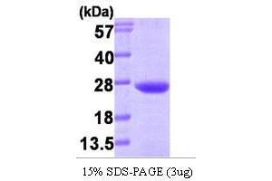 Figure annotation denotes ug of protein loaded and % gel used. (VPS28 Protein (AA 1-221))