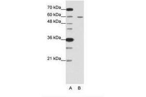 Image no. 2 for anti-Frizzled Family Receptor 5 (FZD5) (C-Term) antibody (ABIN6736225) (FZD5 Antikörper  (C-Term))