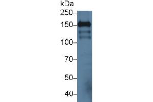 Western blot analysis of Mouse Cerebrum lysate, using Mouse ICAM5 Antibody (3 µg/ml) and HRP-conjugated Goat Anti-Rabbit antibody (