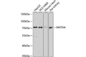 Western blot analysis of extracts of various cell lines, using M antibody (ABIN3016623, ABIN3016624, ABIN1680779 and ABIN6219802) at 1:3000 dilution. (MATN4 Antikörper  (AA 221-540))