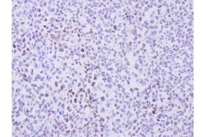 IHC-P Image Immunohistochemical analysis of paraffin-embedded H1299 Xenograft, using cyclin T2, antibody at 1:100 dilution.