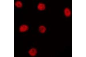 ABIN6274984 staining HepG2 by IF/ICC. (LYAR Antikörper  (Internal Region))