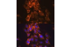 Immunofluorescence analysis of C6 cells using MEK1 antibody (ABIN7268633). (MEK1 Antikörper)