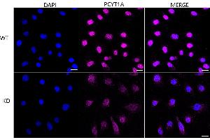Immunocytochemical staining of HeLa cells using PCYT1A antibody (ABIN7799789), 1:1,000), Top panel: wild-type (WT), Bottom panal: PCYT1A shRNA knockdown (KD). (Rekombinanter PCYT1A Antikörper)