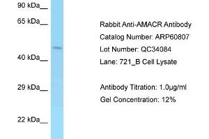 Western Blotting (WB) image for anti-alpha-Methylacyl-CoA Racemase (AMACR) (Middle Region) antibody (ABIN2788590) (AMACR Antikörper  (Middle Region))