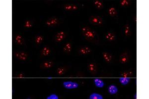 Confocal immunofluorescence analysis of U2OS cells using MYBBP1A Polyclonal Antibody at dilution of 1:200.