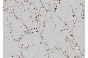 ABIN6269358 at 1/100 staining Human lung tissue by IHC-P. (IRF3 Antikörper  (C-Term))